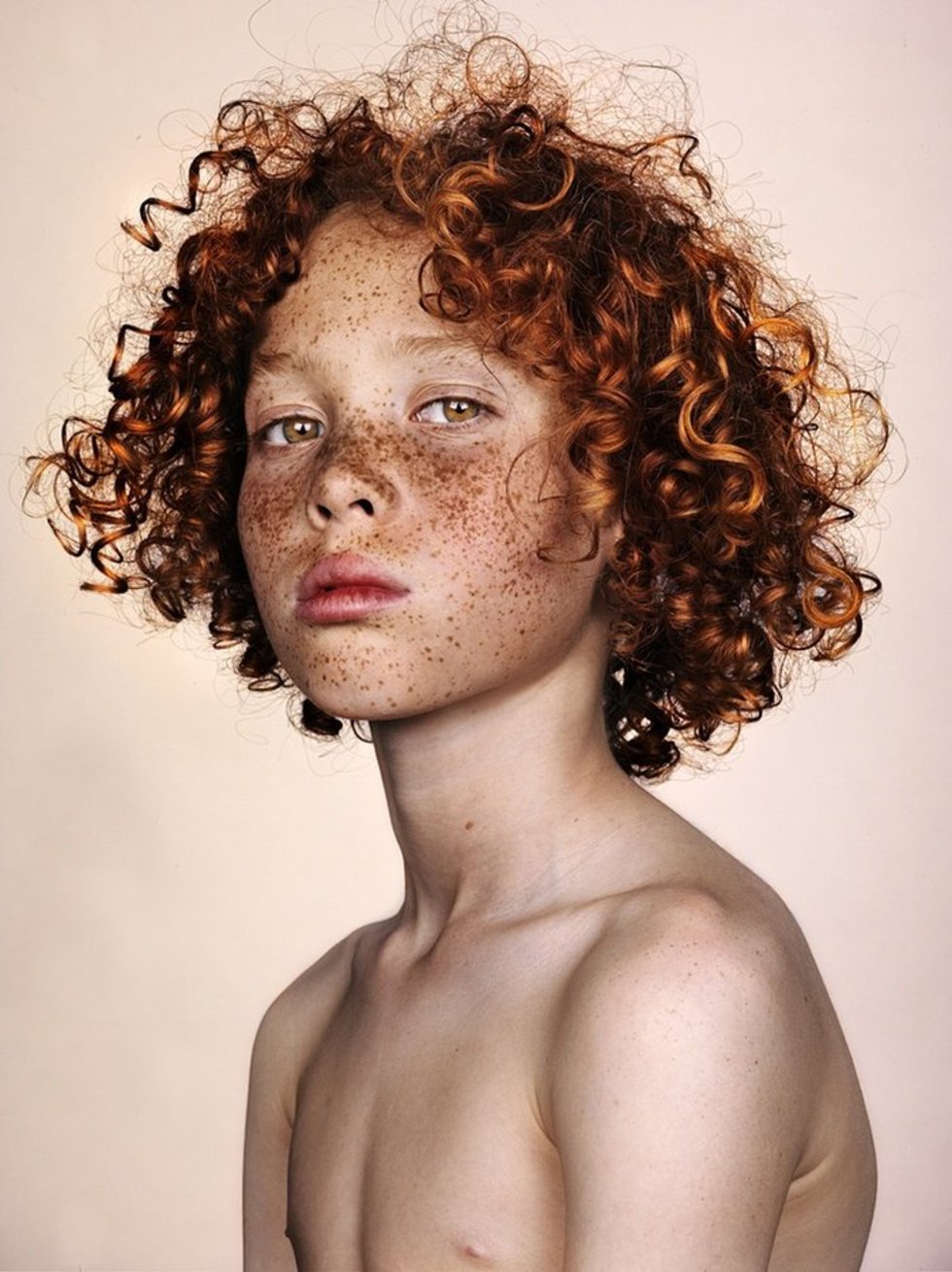 Striking Portraits Celebrate The Beauty Of Freckles | Stylist