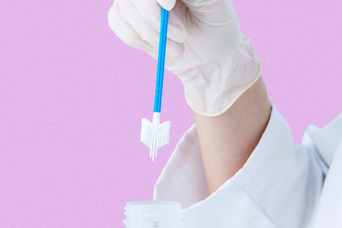 DIY smear test kits everything you need to know